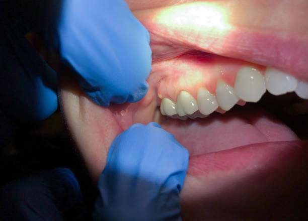 Best Emergency Broken Tooth Repair in Goodview, MN